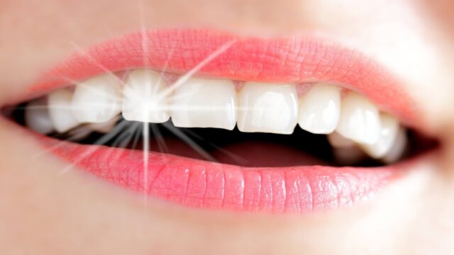 كيف احافظ على اسناني بعد التبييض ؟